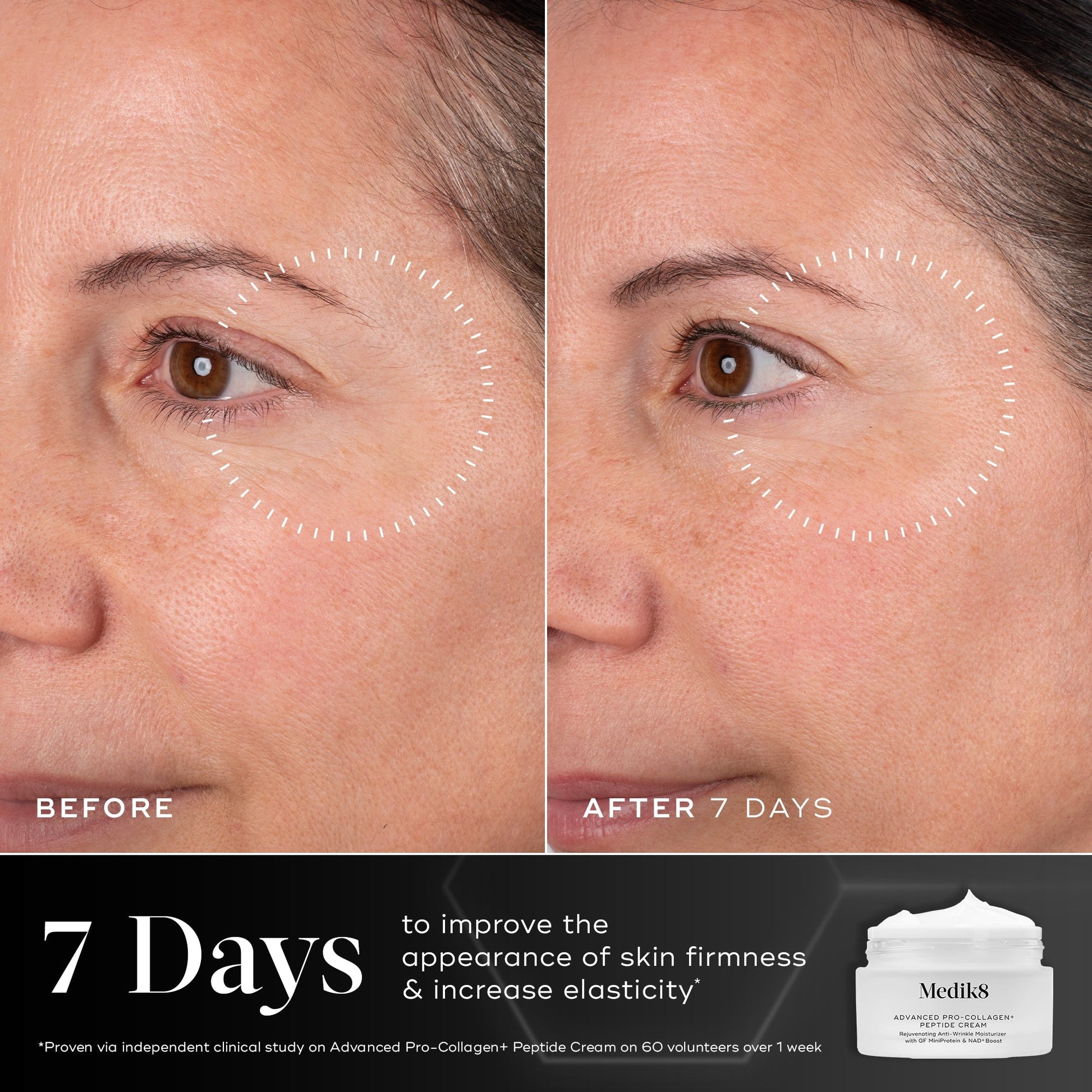 Advanced Youth Renewal Cream